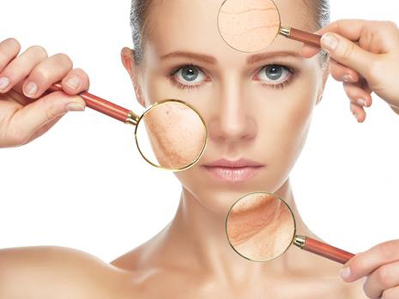 Dị ứng ánh sáng mặt trời: Nguyên nhân do đâu 2