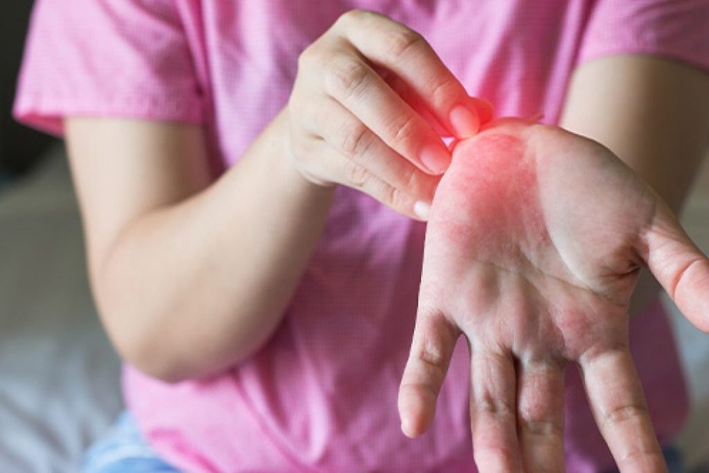 Dị ứng bột giặt: Nguyên nhân, dấu hiệu nhận biết và cách khắc phục 2