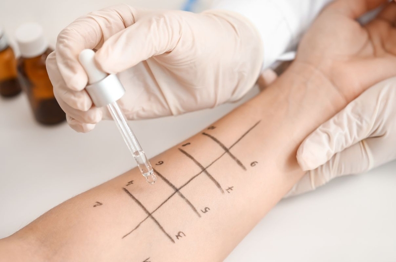 Tình trạng dị ứng cá và những thông tin quan trọng cần biết 3