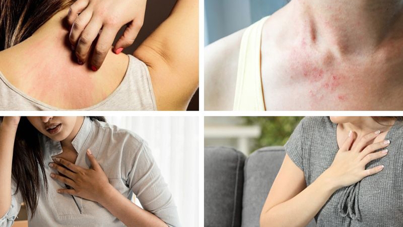 Dị ứng hạt Quinoa nguy hiểm không? Triệu chứng và cách điều trị