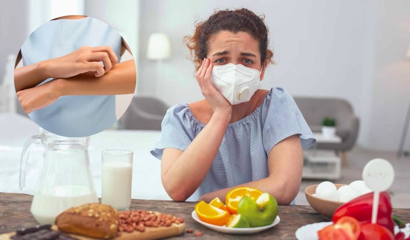 Cần kiêng hải sản để tránh triệu chứng dị ứng tệ&nbsp;hơn