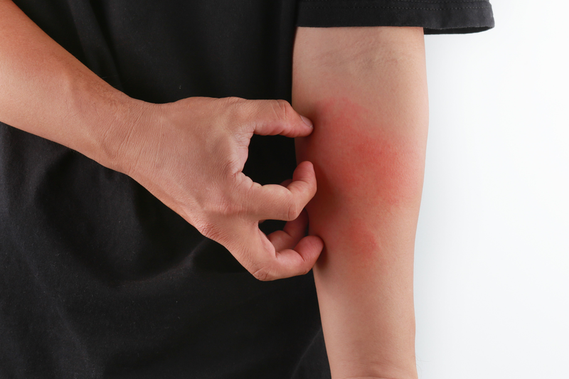 Dị ứng thời tiết là gì? Vì sao bạn bị dị ứng thời tiết?2