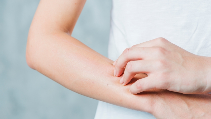 dị ứng thuốc 1