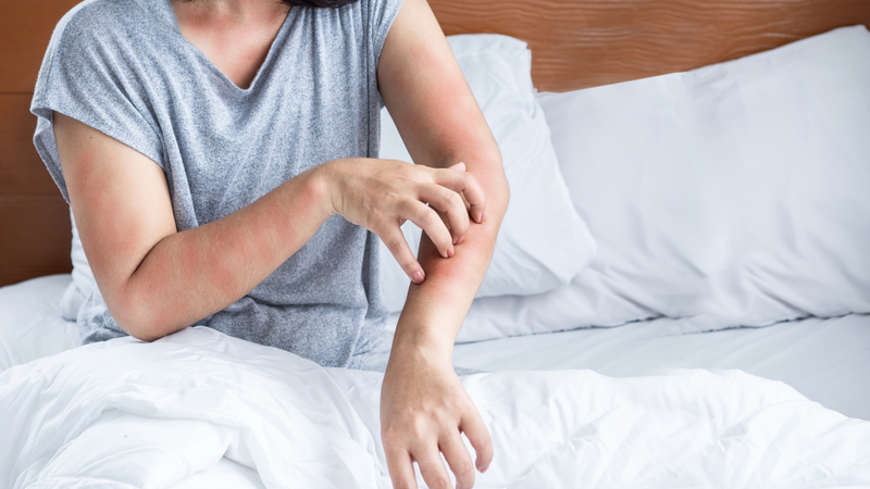 Ban đỏ, ngứa ngáy toàn thân là dấu hiệu thường gặp của dị ứng thuốc