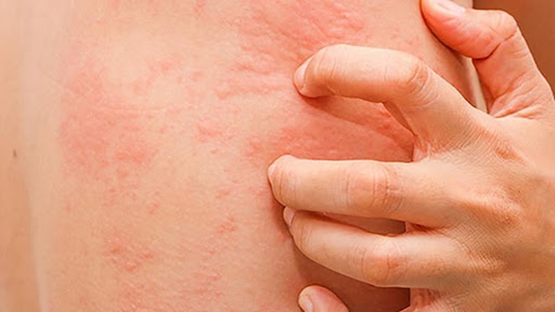 di-ung-thuoc-sat-va-nhung-dieu-can-biet 2