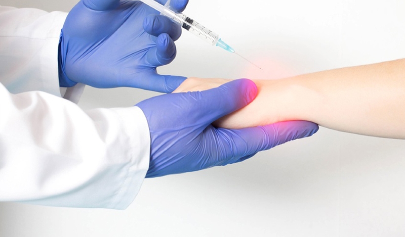 Dị ứng thuốc tê bôi ngoài da có gây nguy hiểm đến tính mạng?