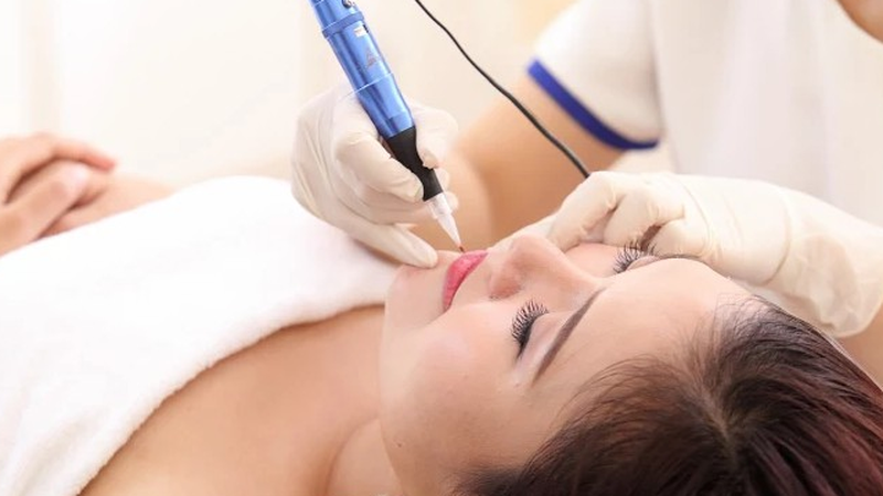 Ngộ độc và dị ứng thuốc tê khi xăm môi sẽ phải đối diện với nguy cơ gì? 1