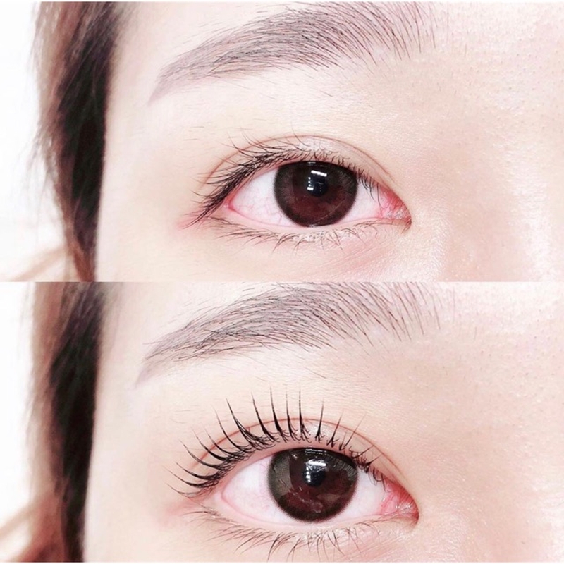 Dị ứng thuốc uốn mi ảnh hưởng đến mắt như thế nào? 2