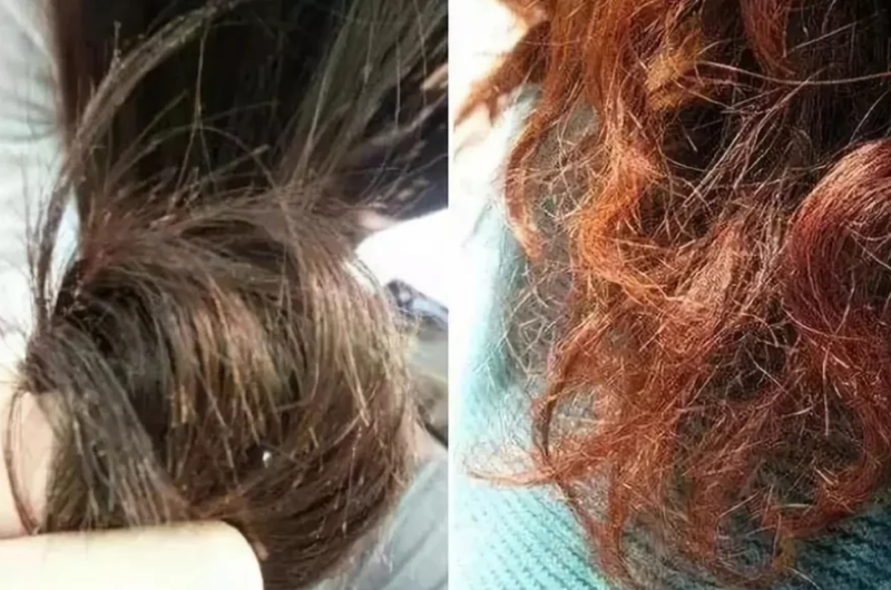 Dị ứng thuốc uốn tóc và những lưu ý khi thực hiện 3