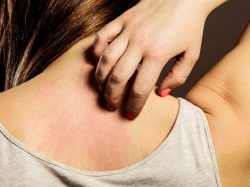 Dị ứng với bao cao su do nguyên nhân nào?