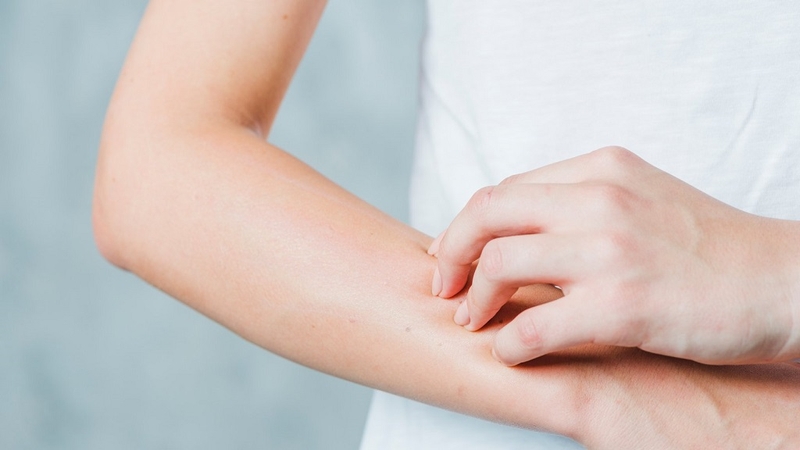 Dị ứng với cây họ đậu là thế nào? Triệu chứng nhận biết và cách điều trị ra sao? 2