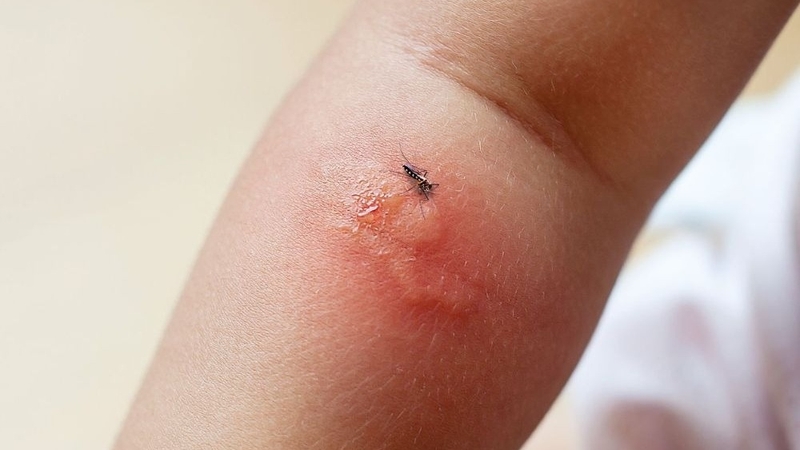 di-ung-voi-dong-vat-va-con-trung-trong-moi-truong 2.jpg