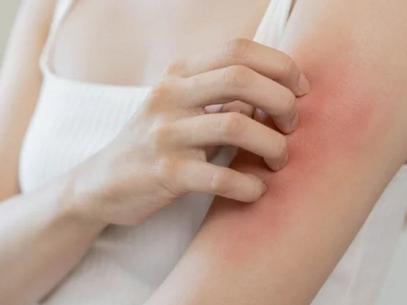 di-ung-voi-dong-vat-va-con-trung-trong-moi-truong 3.jpg