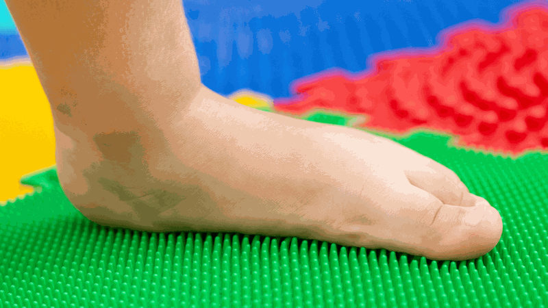 Địa chỉ khám bàn chân bẹt ở Hà Nội 2