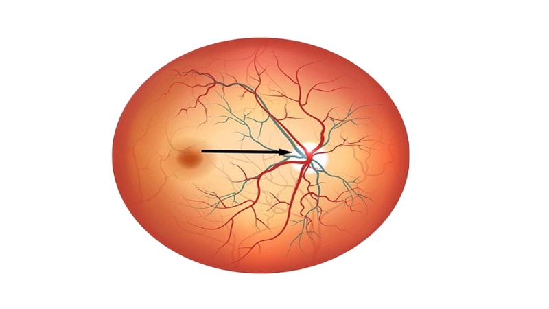 Đĩa thị giác: Cấu tạo, chức năng và một số bệnh lý liên quan 2