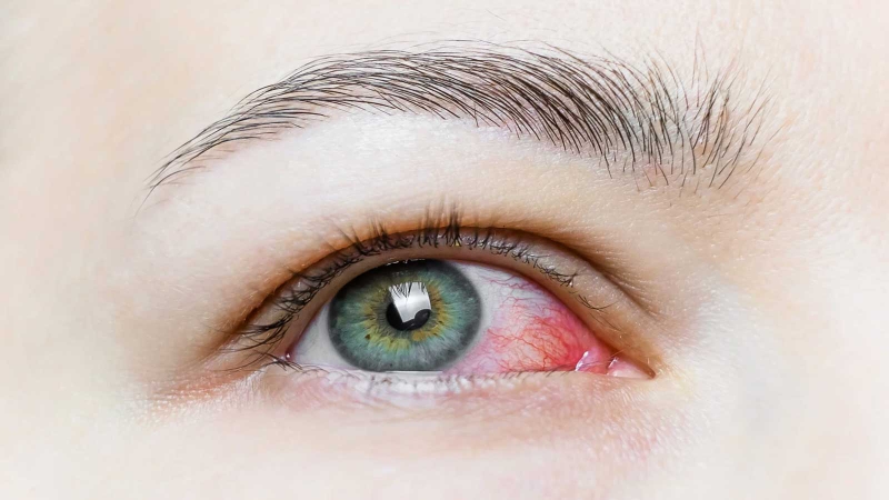 Đĩa thị giác: Cấu tạo, chức năng và một số bệnh lý liên quan 3