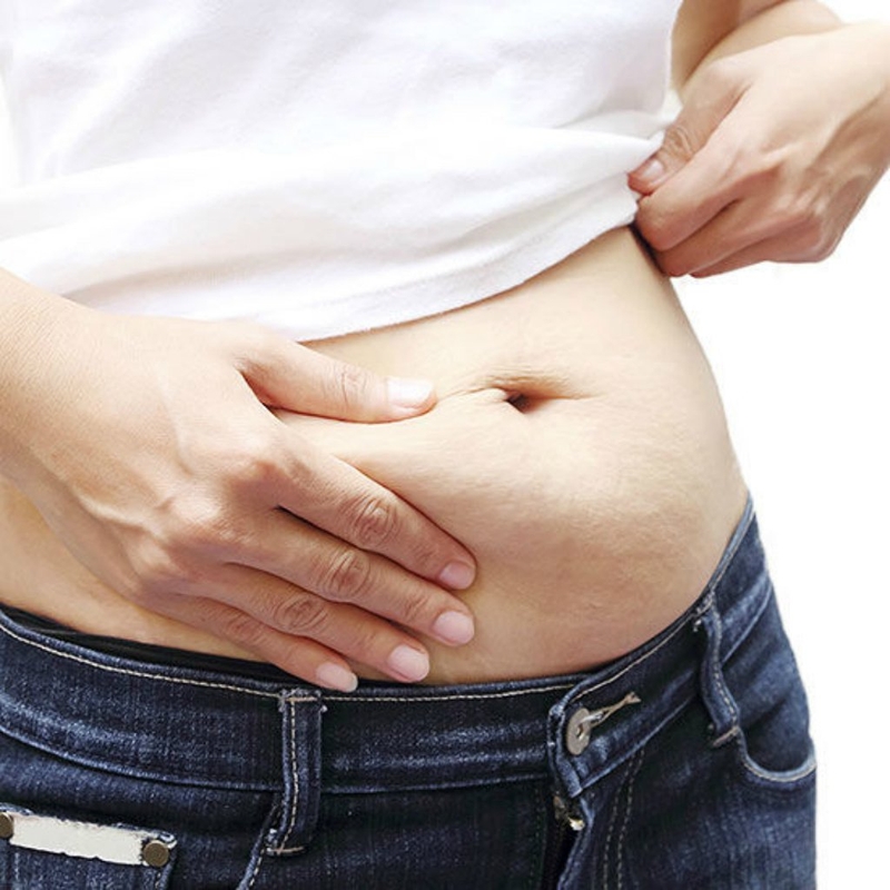 Diastasis recti: phân tách cơ bụng sau sinh và những điều cần biết