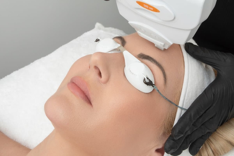 IPL phát ra chùm ánh sáng đa sắc tác động vào hắc sắc tố giúp làm mờ nám