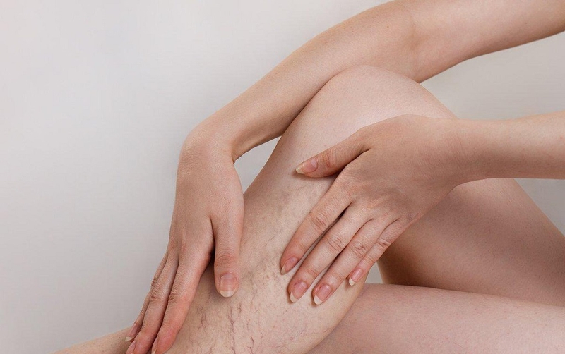 các loại thuốc giãn mạch Điểm danh các loại thuốc giãn mạch phổ biến và những điều cần lưu ý khi sử dụng thuốc 1