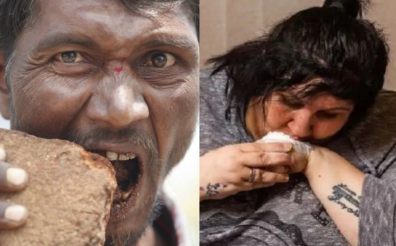 Điểm danh những căn bệnh hiếm gặp nhất thế giới 2