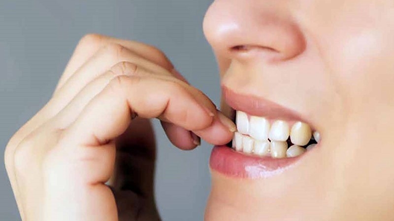 Điểm danh những loại thực phẩm phá hoại men răng 3