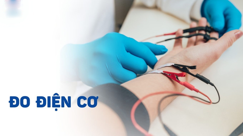 Điện cơ đồ là gì? Tại sao cần tiến hành? 2