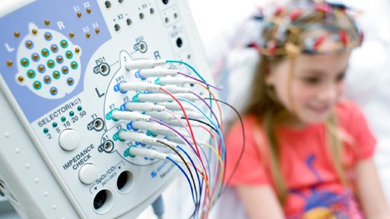 Điện não đồ là gì? Các phương pháp điện não đồ phổ biến nhất hiện nay 4