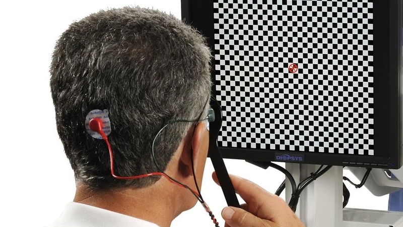 Điện thế gợi thị giác là gì? Ứng dụng của điện thế gợi thị giác 2