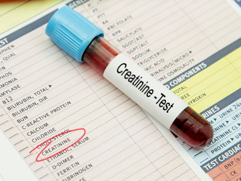 Điều chỉnh liều kháng sinh cho bệnh nhân suy thận và những điều cần biết 3