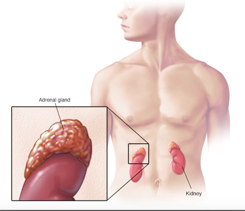Tăng sản thượng thận bẩm sinh gây mức testosteron cao ở nữ giới