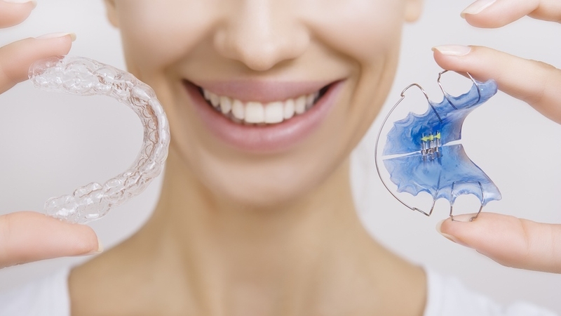 Điều gì xảy ra nếu niềng răng xong không đeo hàm duy trì 3