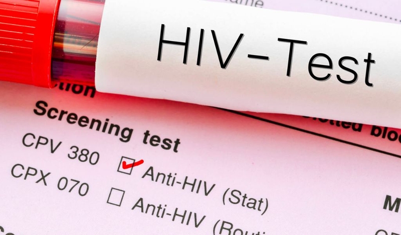 Điều trị bằng thuốc ARV khi nào? Cách uống thuốc ARV đúng 3