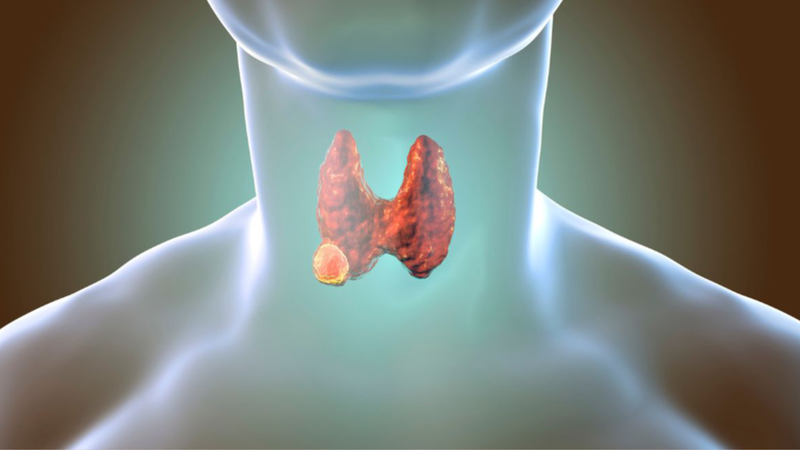 Điều trị iod phóng xạ đối với bệnh nhân ung thư 1