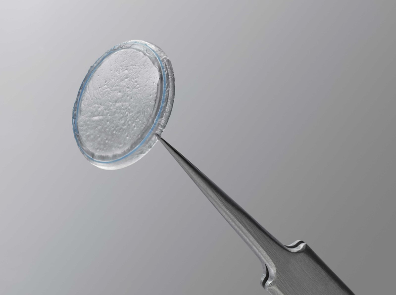 Điều trị khô mắt bằng liệu pháp xung nhiệt LipiFlow