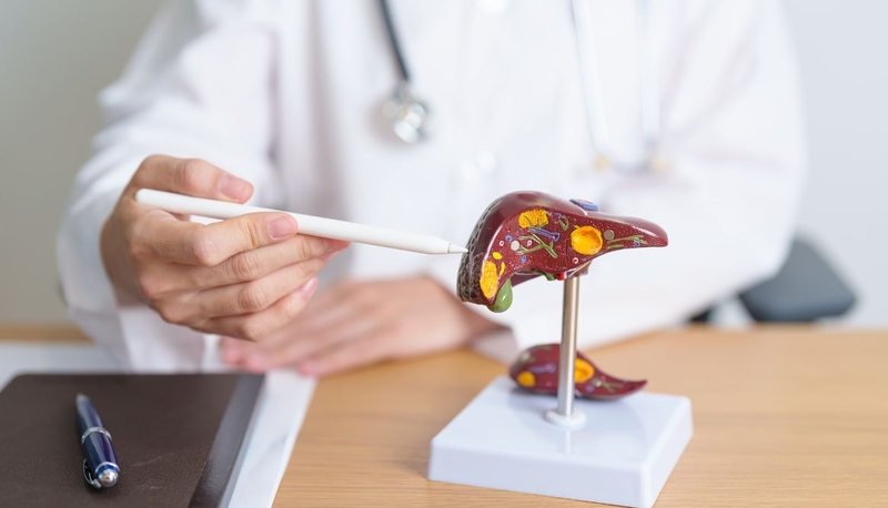 Muốn điều trị mỡ máu cao dứt điểm, đọc ngay cách này 2