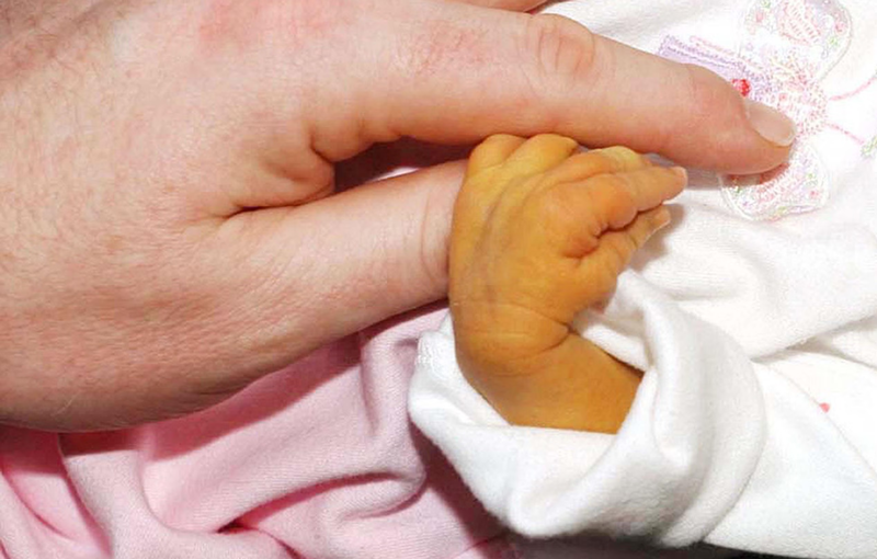 Điều trị teo đường mật bẩm sinh như thế nào? 1