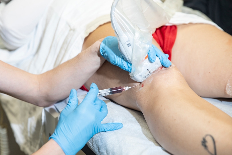 Điều trị thoái hóa khớp gối bằng tế bào gốc - Có hiệu quả hay không? 2