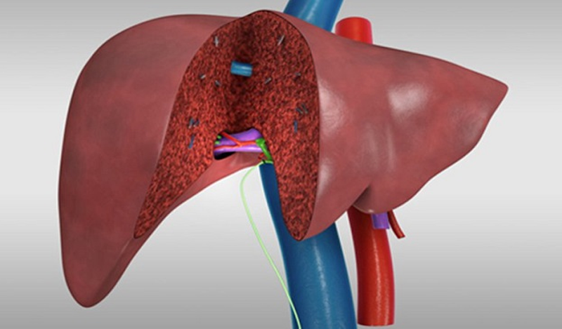 Lựa chọn phương pháp điều trị tùy thuộc vào vị trí của khối ung thư gan