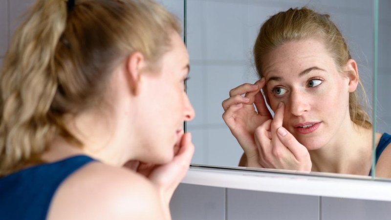 Điều trị và phòng tránh mắt bị lông quặm hiệu quả 4