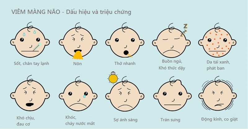 điều trị viêm màng não virus 1