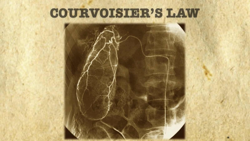 Định luật Courvoisier lấy theo tên của bác sĩ phẫu thuật Ludwig Georg Courvoisier
