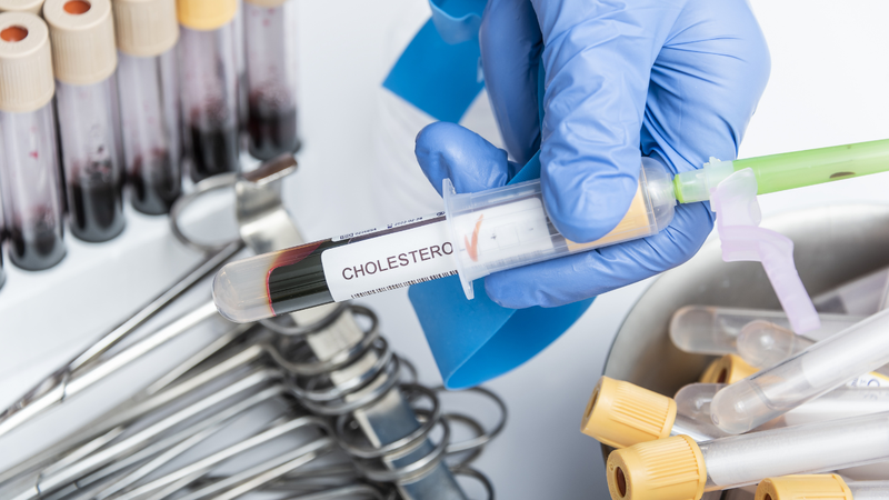 Định lượng cholesterol toàn phần máu cao cảnh báo điều gì? 4