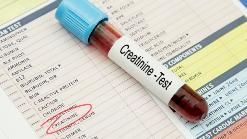Định lượng creatinin là gì? Vai trò của định lượng creatinin 1