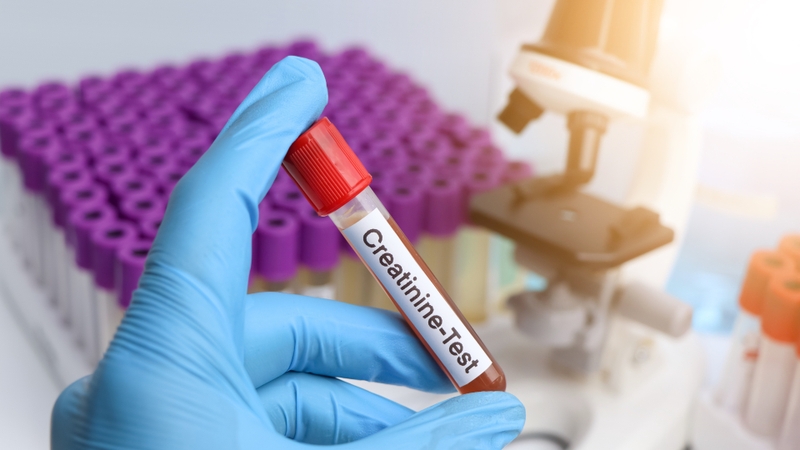 Định lượng creatinin là gì? Vai trò của định lượng creatinin 5