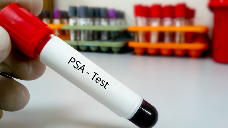 Việc theo dõi PSA định kỳ giúp bác sĩ kịp thời điều chỉnh phác đồ điều trị