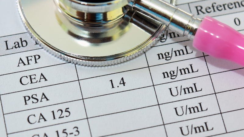 Nồng độ PSA trong máu thay đổi do chịu ảnh hưởng bởi nhiều yếu tố khác nhau