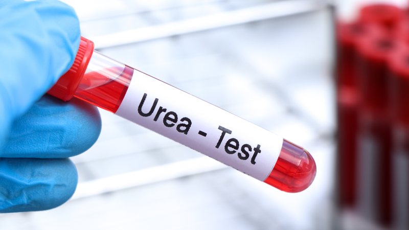 Định lượng ure máu bình thường là bao nhiêu? 4