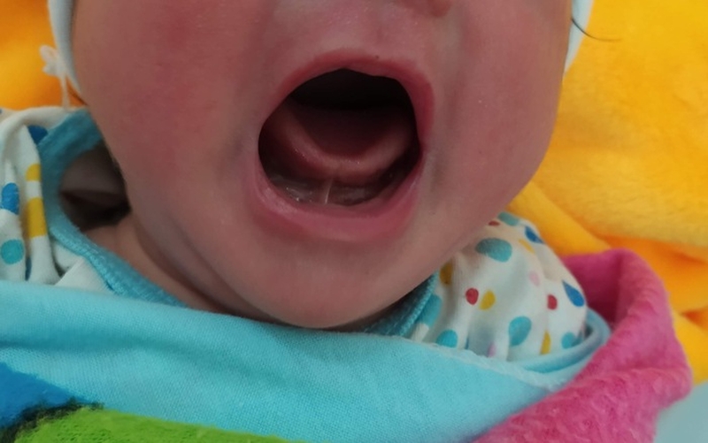 Giải đáp thắc mắc: Tật dính thắng lưỡi có nói được không? 1