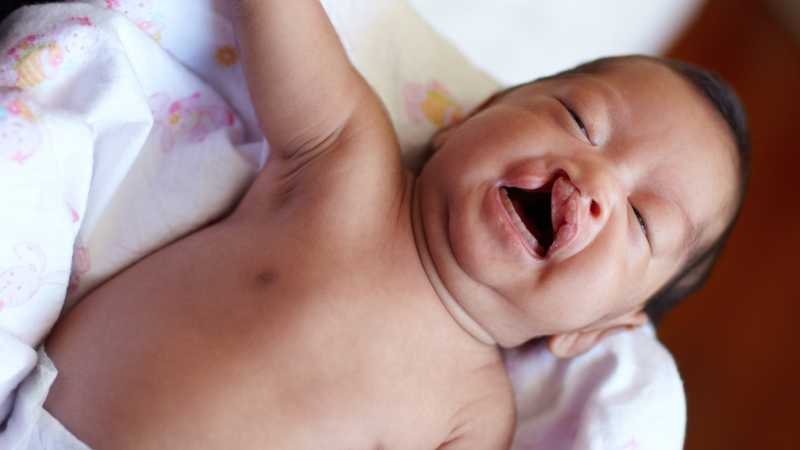 Dính thắng môi trên ở trẻ: Dấu hiệu nhận biết và cách điều trị hiệu quả 4