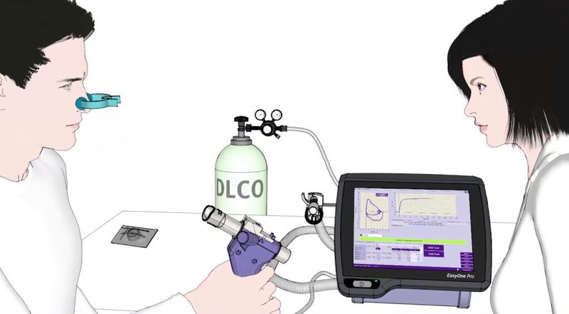 Đo DLCO: Đo khả năng khuếch tán khí qua màng phế nang mao mạch 4